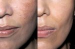 Alpha-5 Mela Cream – Crema Despigmentante 50mL - TIAM - Imagen 3