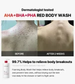 Red Body Wash - Limpiador Antiacné Corporal 400mL - Medicube - Imagen 3