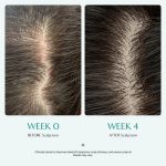 Scalp Turn Cica PDRN Brush Ampoule 100mL - Lilyeve - Imagen 4