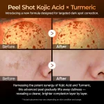 Peel Shot Exfoliating Kojic Acid Turmeric Serum 80ml - Dr.Melaxin - Imagen 2